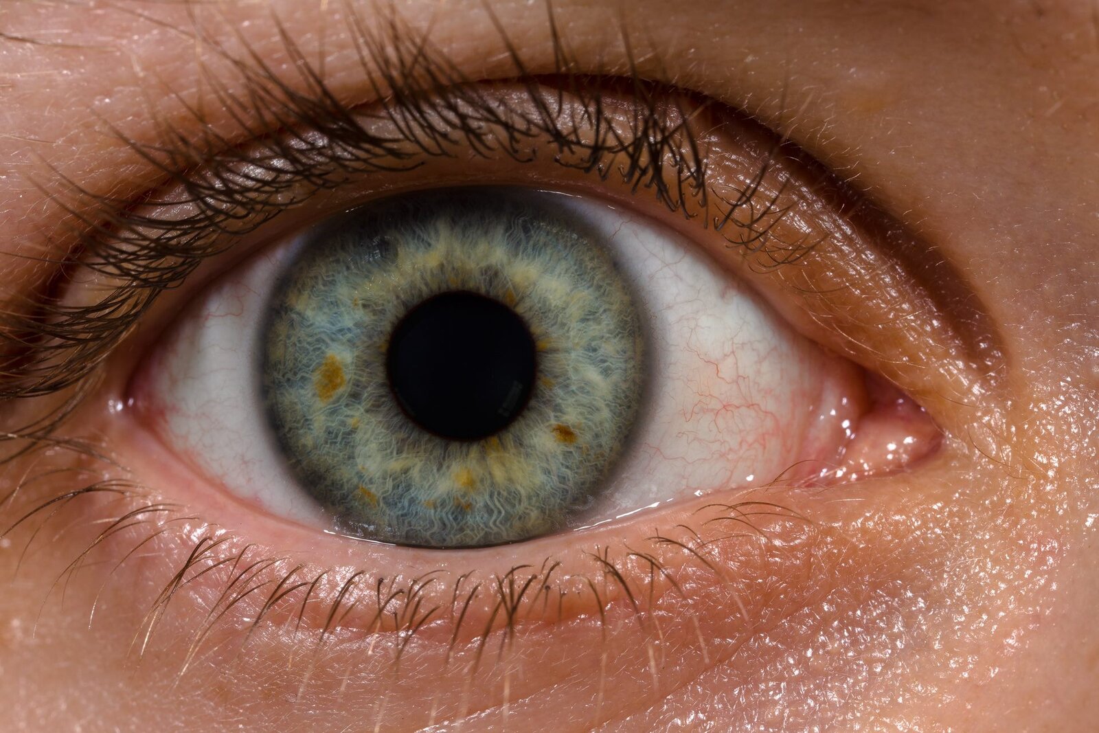 Close-up of a human eye with a blue-grey iris flecked with amber